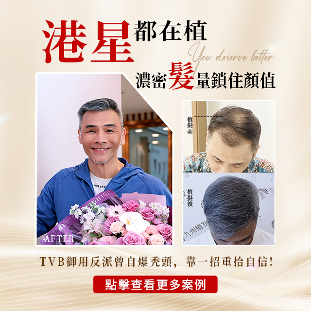 九州植发